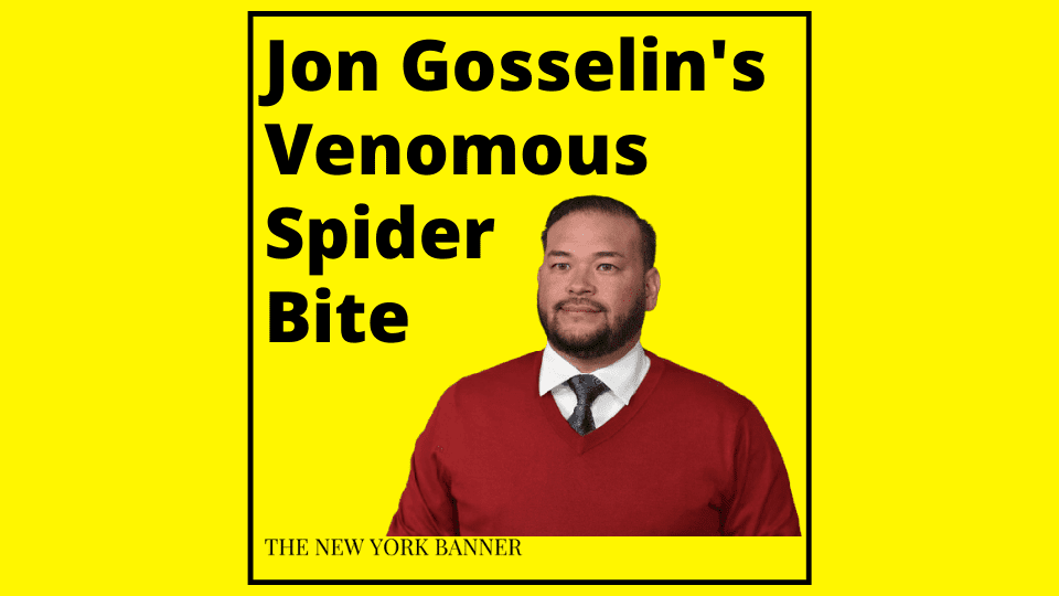 Jon Gosselin's Venomous Spider Bite