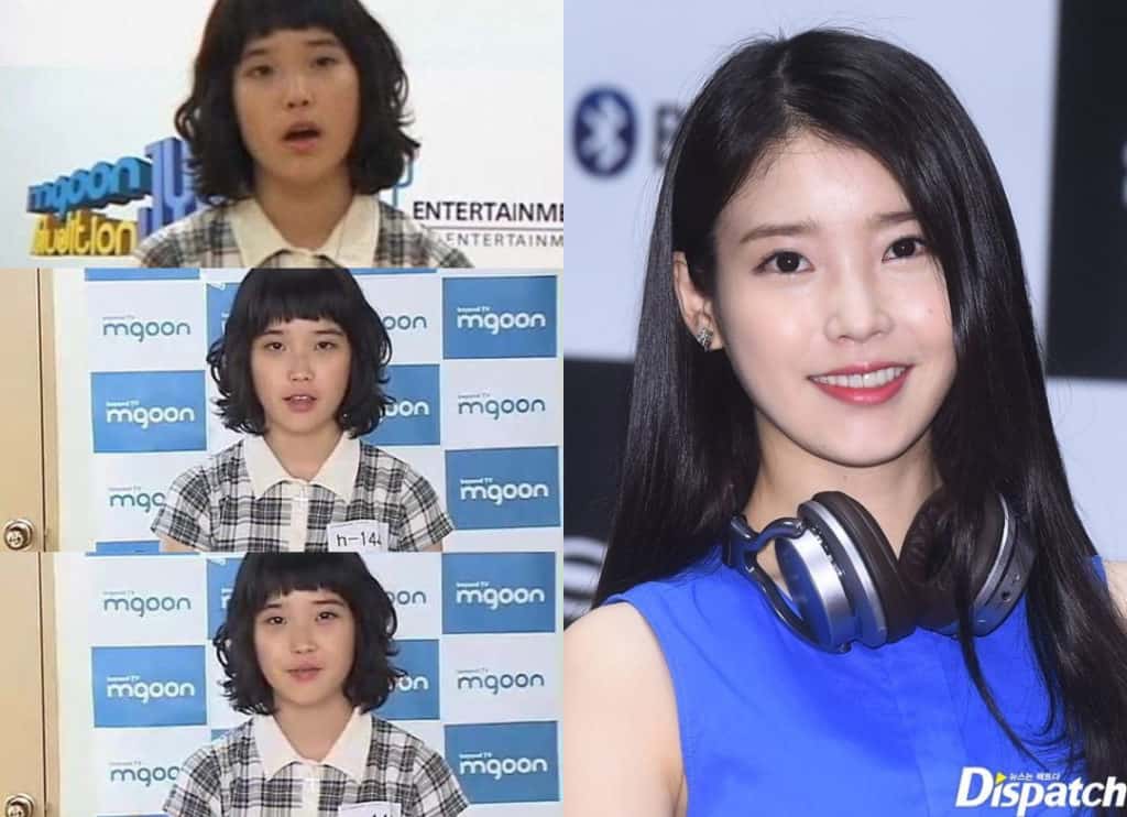 IU Before And After Weight Loss
