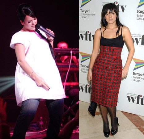 Lily Allen Before and After Weight Loss