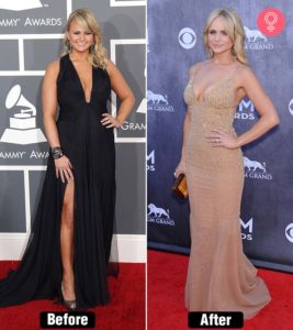 Miranda Lambert Before and After Weight-Loss