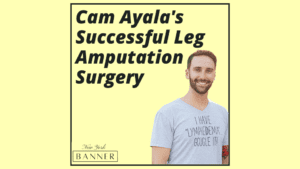 Cam Ayala's Successful Leg Amputation Surgery