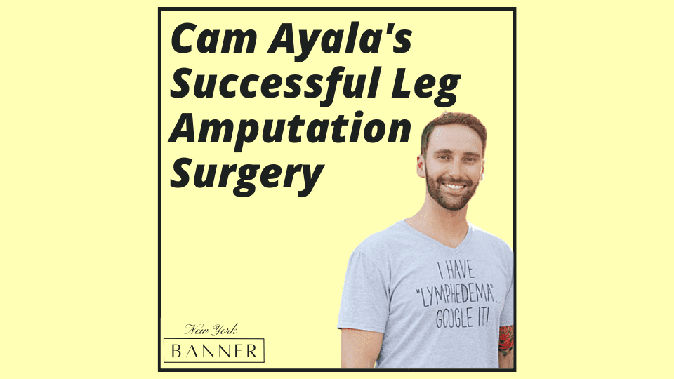Cam Ayala's Successful Leg Amputation Surgery