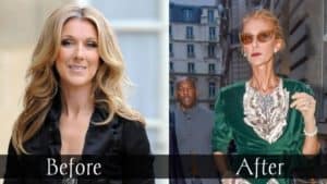 Celine Dion Before And After Weight Loss
