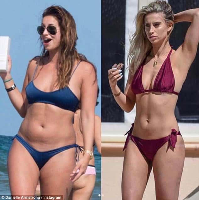 Ferne McCann Before and After Weight Loss