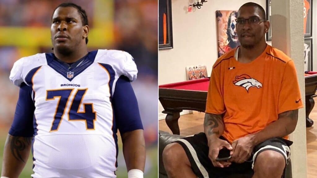 Orlando Franklin Before and After Weight Loss
