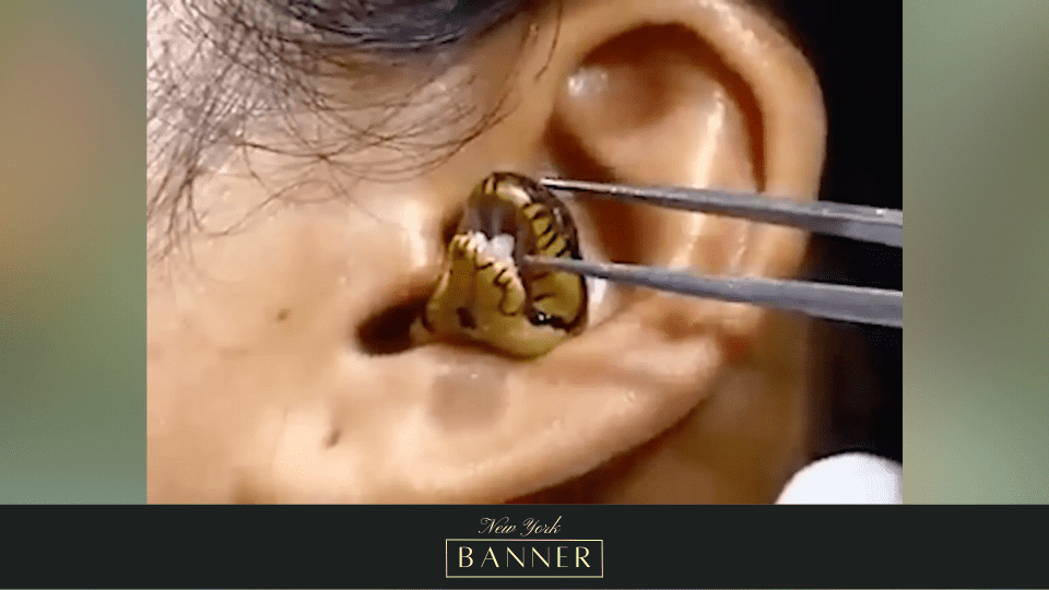 Viral Video “Surgeon” Attempts To Extract A Live Snake From A Woman’s Ear